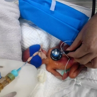 胎龄24周早产宝宝顺利出院！刷新河南早产儿救治成功最低体重