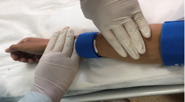 肾友科普动静脉内瘘护理你了解多少