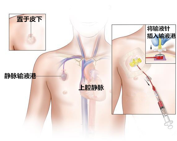 微信图片_20220517213622.png