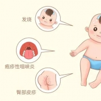 湿热天气易生这些疾病 收下这份8月防病攻略！